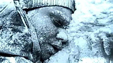 Hipotermi ve lokal donmalara dikkat